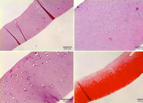 Cartílago articular normal teñido con hematoxilina-eonina y safranina